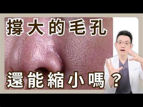 臉上 白毛|臉長白毛位置暗示何事？